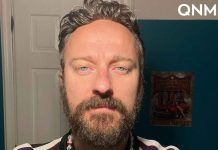 Francesco Facchinetti capelli